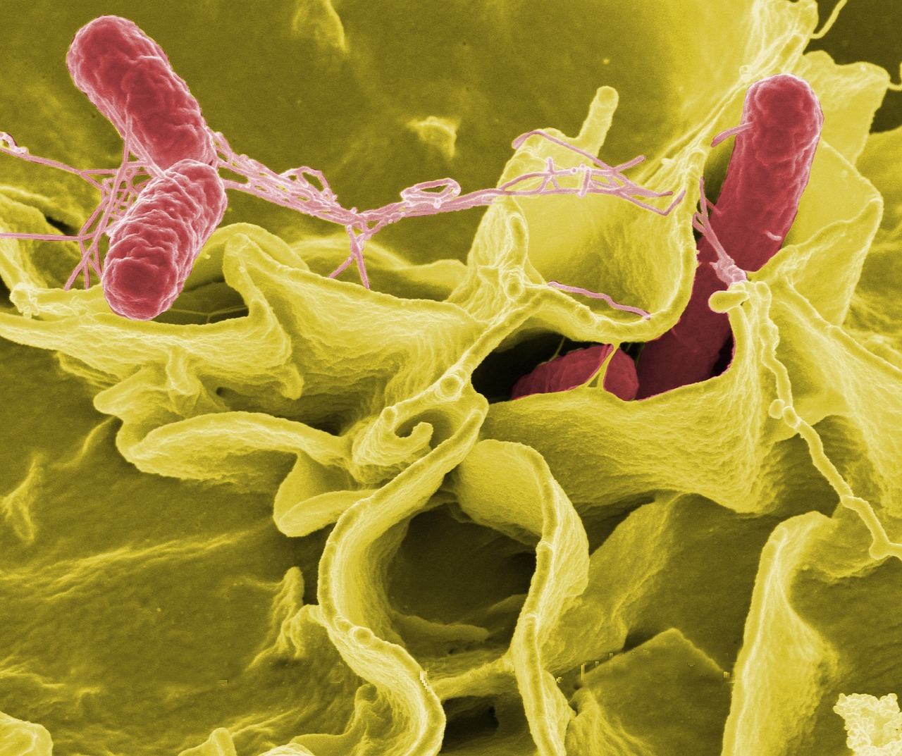 pathogenic